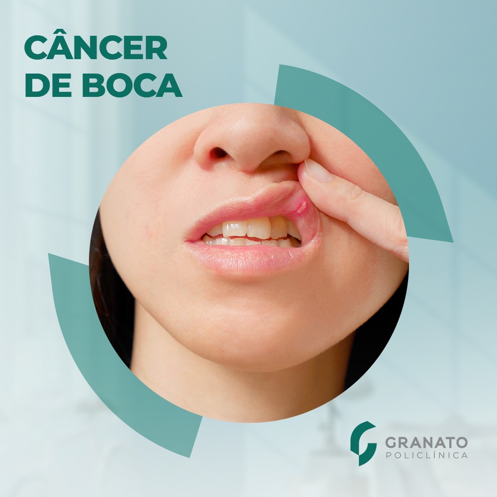 Como identificar um possível câncer na boca?