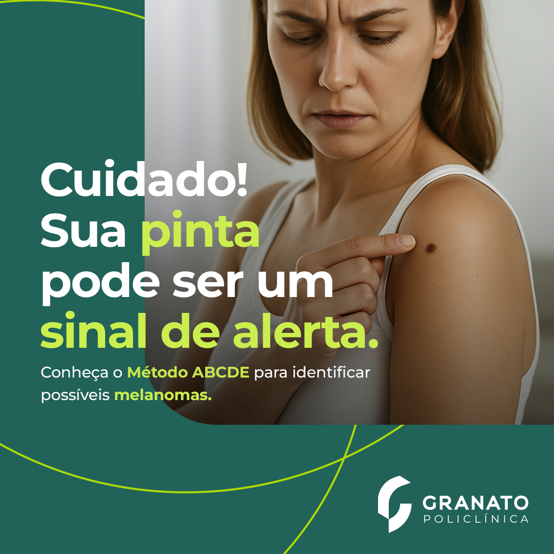 Sua pinta pode ser um sinal de alerta! Conheça o método ABCDE para identificar possíveis melanomas