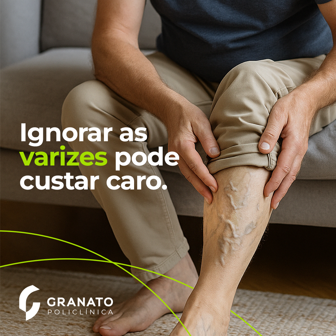 Varizes: quando o problema vai além da estética